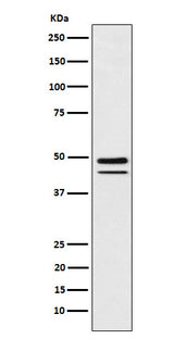 Anti-Brachyury Rabbit Monoclonal Antibody Boster Bio