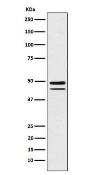 Anti-Brachyury Rabbit Monoclonal Antibody Boster Bio