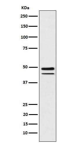 Anti-Brachyury Rabbit Monoclonal Antibody Boster Bio