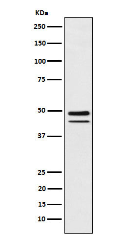 Anti-Brachyury Rabbit Monoclonal Antibody Boster Bio