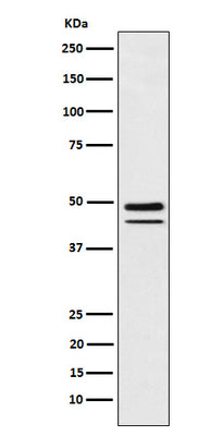 Anti-Brachyury Rabbit Monoclonal Antibody Boster Bio
