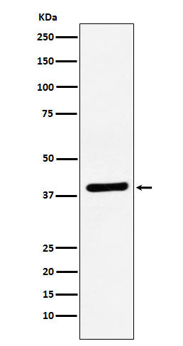 Anti-VEGFD Rabbit Monoclonal Antibody Boster Bio