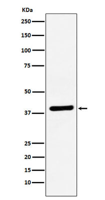 Anti-VEGFD Rabbit Monoclonal Antibody Boster Bio