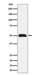 Anti-CCDC98 Rabbit Monoclonal Antibody Boster Bio