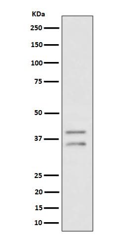 Anti-UFD1L Rabbit Monoclonal Antibody Boster Bio
