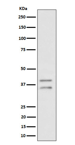 Anti-UFD1L Rabbit Monoclonal Antibody Boster Bio