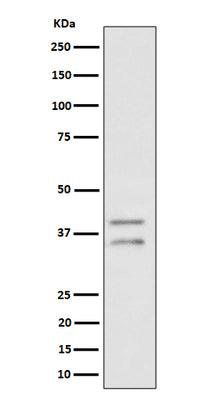 Anti-UFD1L Rabbit Monoclonal Antibody Boster Bio