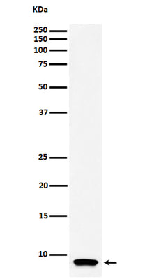 Anti-ATP5G1 Rabbit Monoclonal Antibody Boster Bio