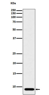 Anti-ATP5G1 Rabbit Monoclonal Antibody Boster Bio