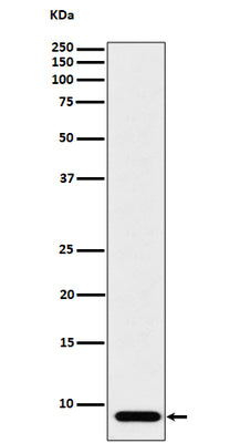 Anti-ATP5G1 Rabbit Monoclonal Antibody Boster Bio