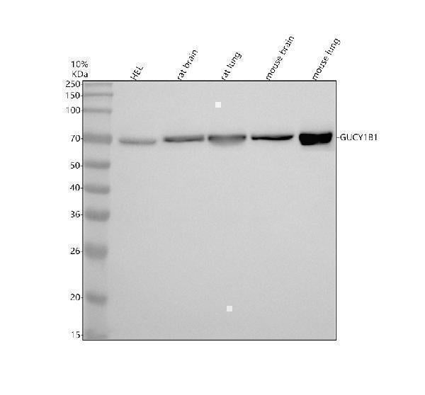 Anti-Guanylyl Cyclase beta 1 Rabbit Monoclonal Antibody Boster Bio