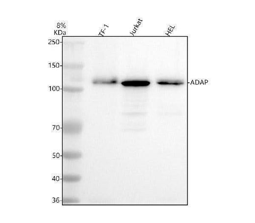 Anti-FYB Rabbit Monoclonal Antibody Boster Bio