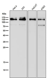 Anti-MGEA5 Rabbit Monoclonal Antibody Boster Bio