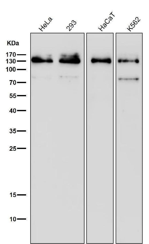 Anti-MGEA5 Rabbit Monoclonal Antibody Boster Bio