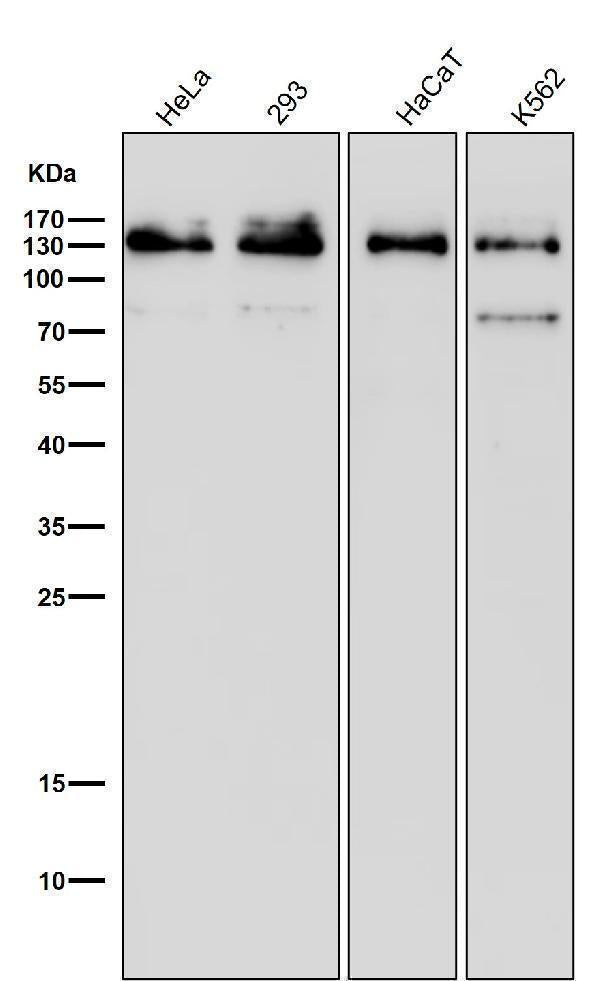 Anti-MGEA5 Rabbit Monoclonal Antibody Boster Bio