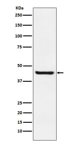 Anti-Septin 2 Rabbit Monoclonal Antibody Boster Bio