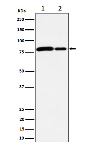 Anti-MMUT Rabbit Monoclonal Antibody Boster Bio