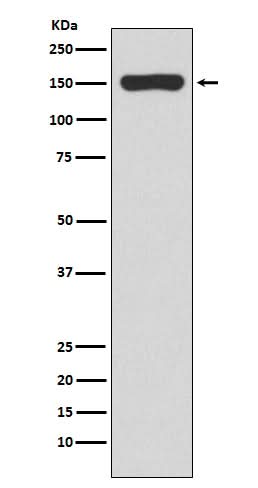 Anti-RNA polymerase beta Rabbit Monoclonal Antibody Boster Bio