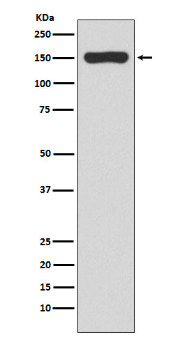 Anti-RNA polymerase beta Rabbit Monoclonal Antibody Boster Bio