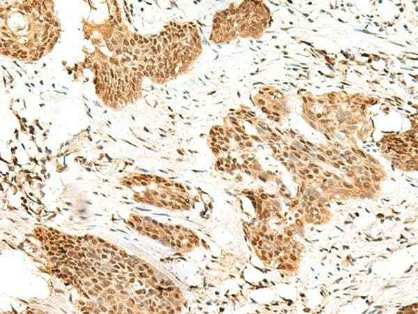 Anti-Human/Mouse RBM19 Antibody