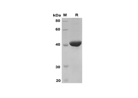 SDS-PAGE analysis of Human S100A9 proteins, 2 μg/lane of Recombinant Human S100A9 proteins was resolved with SDS-PAGE under reducing conditions, showing bands at 40 kDa.