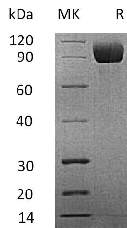 Recombinant Mouse IL13RA1 Protein (Fc Tag) - ABMIUM