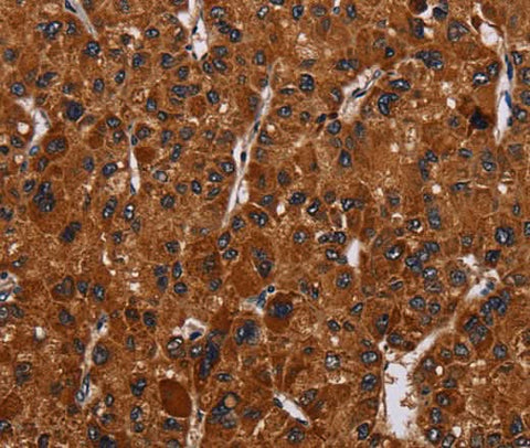 Anti-Human/Mouse/Rat RTN4R Antibody - ABMIUM