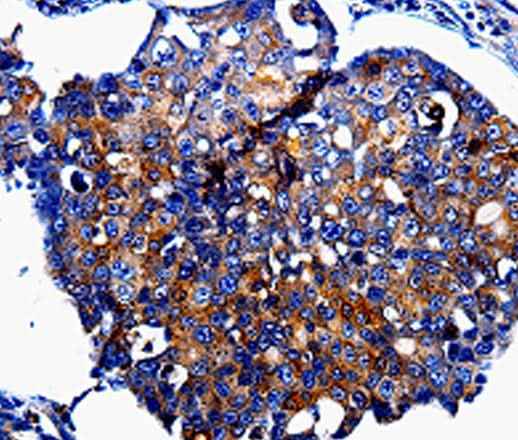 Anti-Human IL10RB Antibody