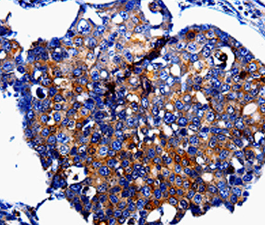 Anti-Human IL10RB Antibody - ABMIUM