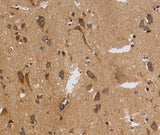 Anti-Human ITPR3 Antibody - ABMIUM