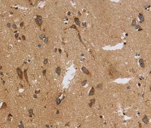 Anti-Human ITPR3 Antibody