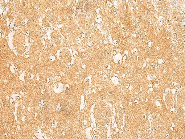 Immunohistochemistry of paraffin-embedded Human brain tissue using ARPC5L Polyclonal Antibody at dilution of 1:45(×200)