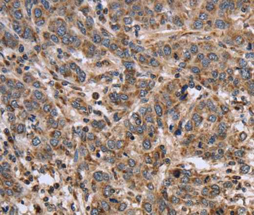 Anti-Human/Mouse/Rat EPOR Antibody