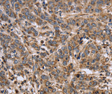 Anti-Human/Mouse/Rat EPOR Antibody - ABMIUM