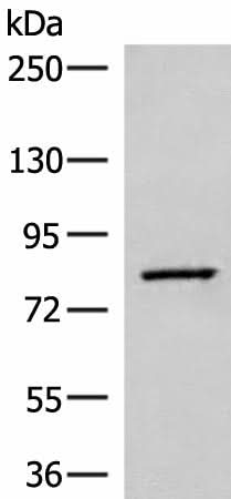 Western blot analysis of Human hepatocellular carcinoma tissue lysate using SLC26A3 Polyclonal Antibody at dilution of 1:250