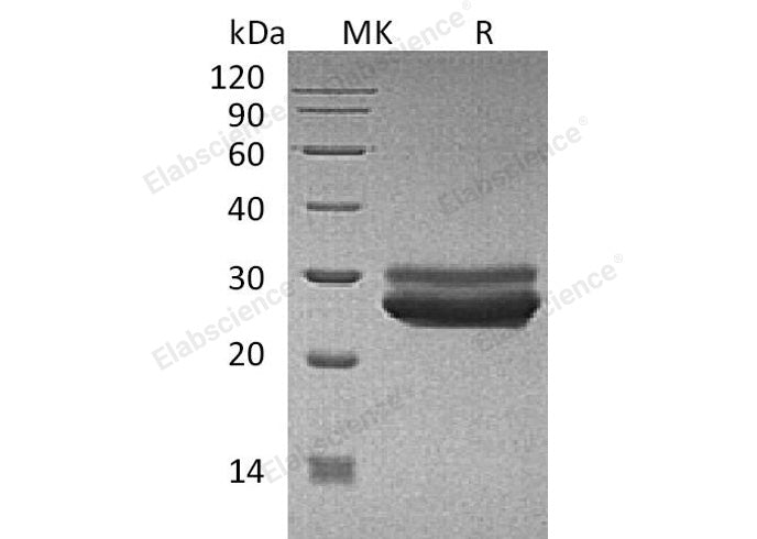 Recombinant Human Prolactin/PRL Protein (His Tag) - ABMIUM