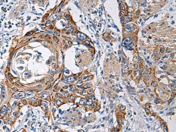Anti-Human RITA1 Antibody
