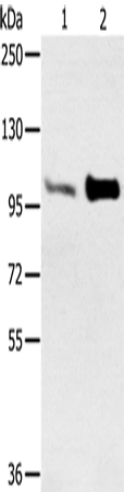 Anti-Human/Mouse ACTN2 Antibody - ABMIUM