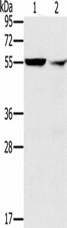Anti-Human PPM1F Antibody - ABMIUM