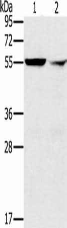 Anti-Human PPM1F Antibody