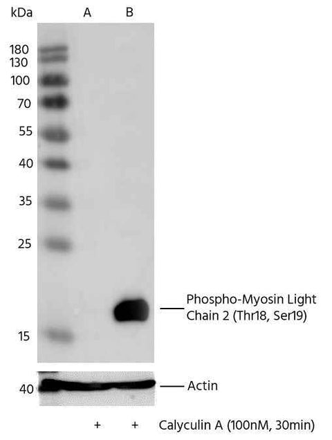 Anti-Human MYL9 Antibody [B142] - ABMIUM
