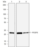 Anti-Human/Rat/Mouse PCGF5 Antibody [A765]