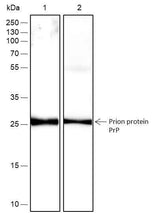Anti-Human/Rat/Mouse Prion protein PrP Antibody [A418]