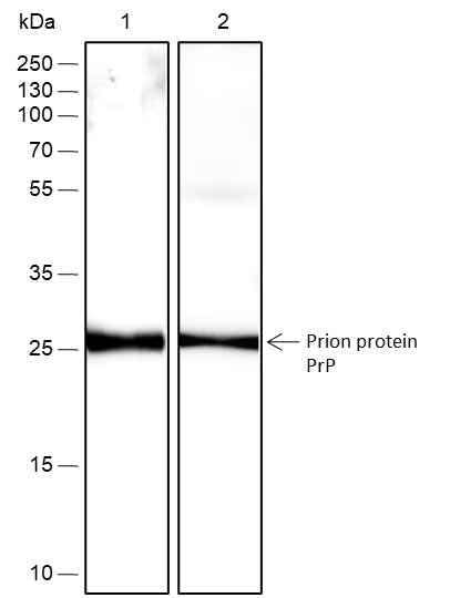 Anti-Human/Rat/Mouse Prion protein PrP Antibody [A418] - ABMIUM