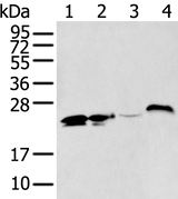 Anti-Human BCAS4 Antibody - ABMIUM