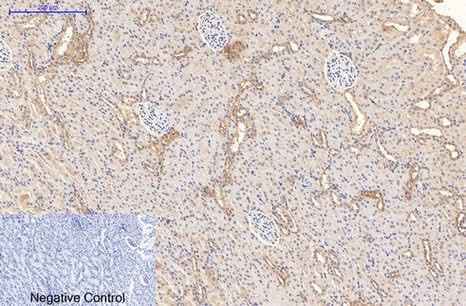 Anti-Human/Mouse/Rat CD21 Antibody [5F2]
