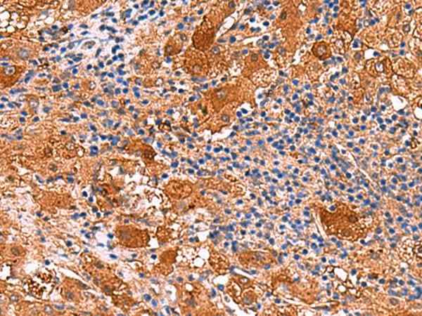 Anti-Human/Mouse KANK3 Antibody