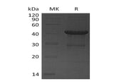 Recombinant Human UBE2D4 Protein (GST Tag) - ABMIUM