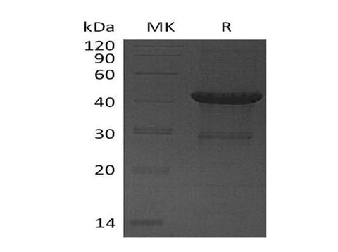 Recombinant Human UBE2D4 Protein (GST Tag) - ABMIUM