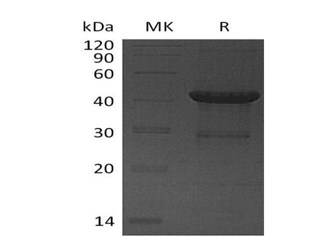 Recombinant Human UBE2D4 Protein (GST Tag) - ABMIUM